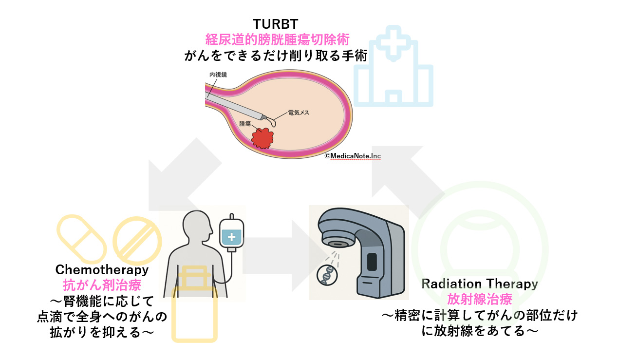 Precision CRT(精細化学放射線療法)